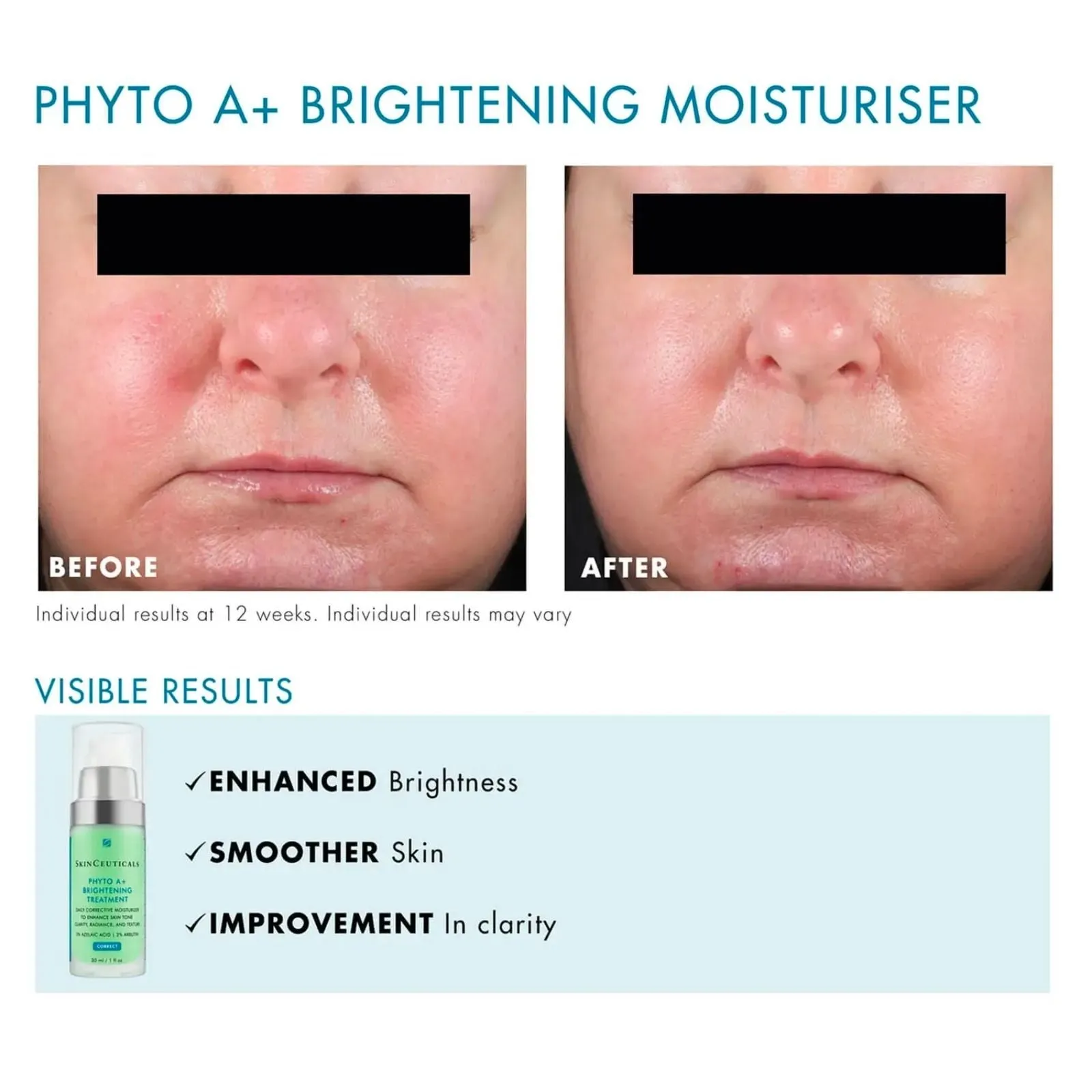 SkinCeuticals | Phyto A  Brightening Treatment 30ml